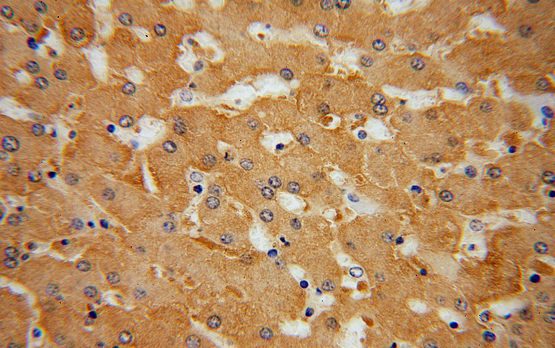 Immunohistochemical of paraffin-embedded human liver using Catalog No:113857(PKLR antibody) at dilution of 1:100 (under 40x lens)
