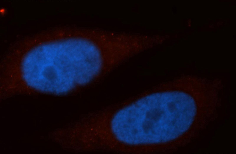 Immunofluorescent analysis of MCF-7 cells, using EIF3D antibody Catalog No:110192 at 1:50 dilution and Rhodamine-labeled goat anti-rabbit IgG (red). Blue pseudocolor = DAPI (fluorescent DNA dye).