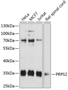 Western blot - PRPS2 Polyclonal Antibody 