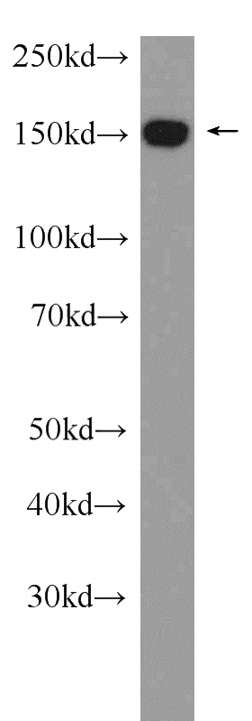 HeLa cells were subjected to SDS PAGE followed by western blot with Catalog No:109934(DHX57 Antibody) at dilution of 1:1000