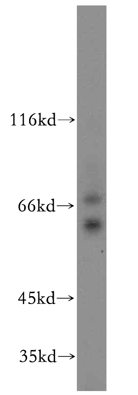 mouse brain tissue were subjected to SDS PAGE followed by western blot with Catalog No:109571(DPYSL2 antibody) at dilution of 1:500