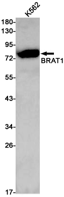 Western blot detection of BRAT1 in K562 cell lysates using BRAT1 Rabbit pAb(1:1000 diluted).Predicted band size:88kDa.Observed band size:88kDa.