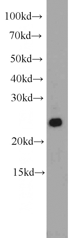 HeLa cells were subjected to SDS PAGE followed by western blot with Catalog No:108181(ARHGDIG antibody) at dilution of 1:1000