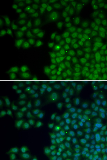 Immunofluorescence - NUDT6 Polyclonal Antibody 