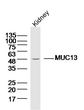 Fig1: Sample:Kidney (Mouse)Lysate at 40 ug; Primary: Anti- MUC13 at 1/300 dilution; Secondary: IRDye800CW Goat Anti-RabbitIgG at 1/20000 dilution; Predicted band size: 54kD; Observed band size: 54kD