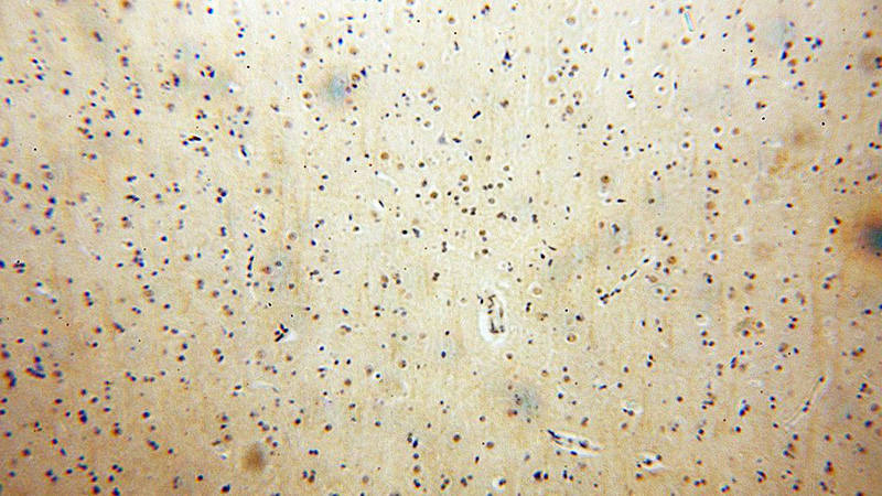 Immunohistochemical of paraffin-embedded human brain using Catalog No:115954(TEX10 antibody) at dilution of 1:200 (under 10x lens)