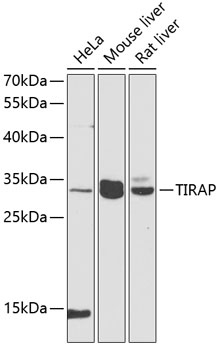 Western blot - TIRAP Polyclonal Antibody 