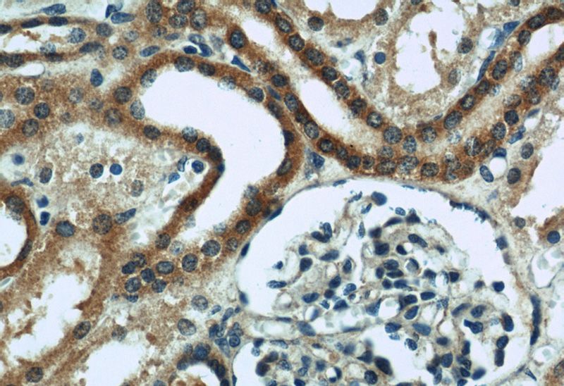Immunohistochemical of paraffin-embedded human kidney using Catalog No:117045(ZFYVE16 antibody) at dilution of 1:200 (under 40x lens)
