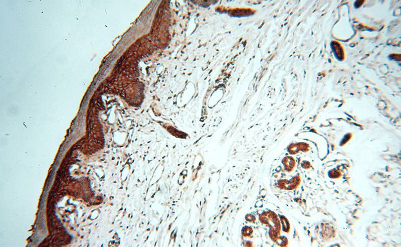 Immunohistochemical of paraffin-embedded human skin using Catalog No:110288(E-cadherin antibody) at dilution of 1:50 (under 10x lens)