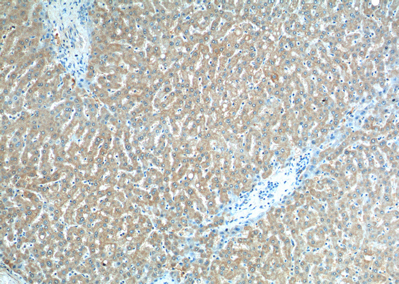Immunohistochemistry of paraffin-embedded human liver tissue slide using Catalog No:107163(CLTB Antibody) at dilution of 1:200 (under 10x lens).