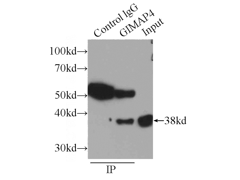 IP Result of anti-GIMAP4 (IP:Catalog No:110973, 3ug; Detection:Catalog No:110973 1:800) with Jurkat cells lysate 1080ug.
