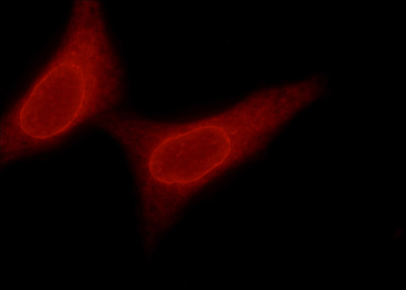 Immunofluorescent analysis of HepG2 cells using Catalog No:116284(TMX4 Antibody) at dilution of 1:50 and and Rhodamine-labeled goat anti-rabbit IgG (red).