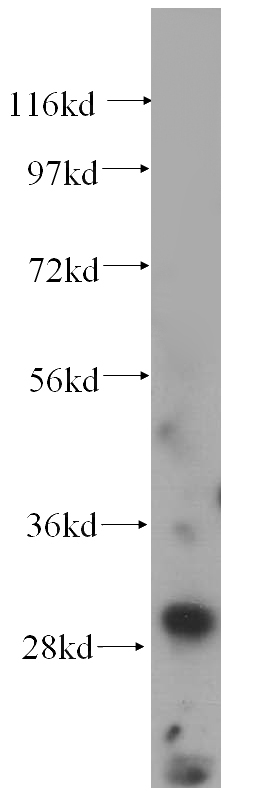HeLa cells were subjected to SDS PAGE followed by western blot with Catalog No:109627(CUTC antibody) at dilution of 1:500