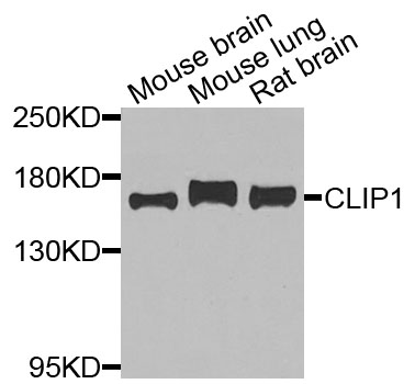 Western blot - CLIP1 Polyclonal Antibody 