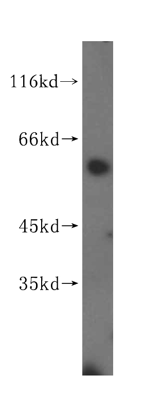 mouse thymus tissue were subjected to SDS PAGE followed by western blot with Catalog No:112086(KLHDC4 antibody) at dilution of 1:500