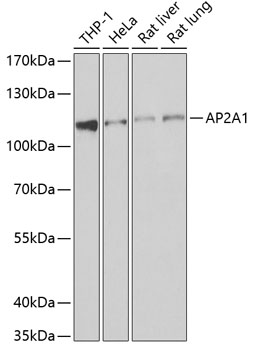 Western blot - AP2A1 Polyclonal Antibody 