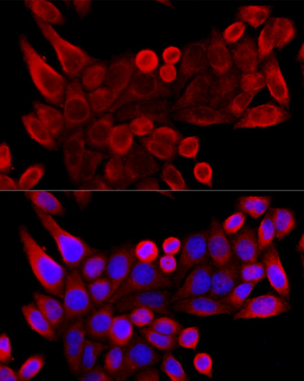 Immunofluorescence - VDAC3 Polyclonal Antibody 