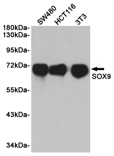 Western blot analysis of extracts from SW480, HCT116 and 3T3 cells using Sox9 Rabbit pAb at 1:1000 dilution. Predicted band size: 70kDa. Observed band size: 70kDa.