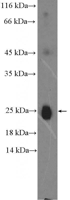 human plasma (0.3ug) tissue were subjected to SDS PAGE followed by western blot with Catalog No:111694(IgG light chain (lambda) Antibody) at dilution of 1:1000