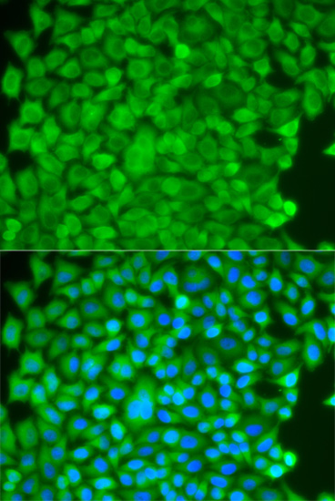 Immunofluorescence - SGCE Polyclonal Antibody 