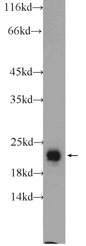 rat brain tissue were subjected to SDS PAGE followed by western blot with Catalog No:114418(RAB2A Antibody) at dilution of 1:1000