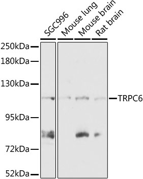 Western blot - TRPC6 Polyclonal Antibody 