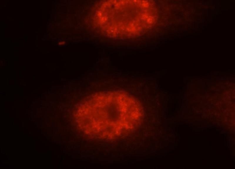 Immunofluorescent analysis of MCF-7 cells, using NASP antibody Catalog No:112958 at 1:25 dilution and Rhodamine-labeled goat anti-rabbit IgG (red).