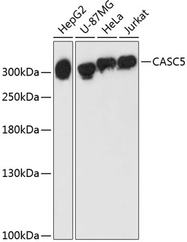 Western blot - CASC5 Polyclonal Antibody 