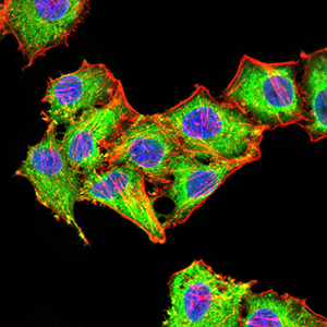 Fig5: ICC staining Rab6b (green) and Actin filaments (red) in HepG2 cells. The nuclear counter stain is DAPI (blue). Cells were fixed in paraformaldehyde, permeabilised with 0.25% Triton X100/PBS.