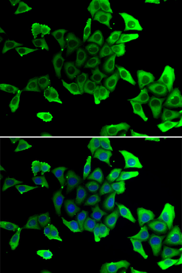 Immunofluorescence - SGCD Polyclonal Antibody 