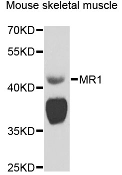 Western blot - MR1 Polyclonal Antibody 