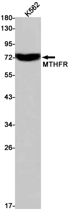 Western blot detection of MTHFR in K562 cell lysates using MTHFR Rabbit pAb(1:1000 diluted).Predicted band size:75kDa.Observed band size:75kDa.