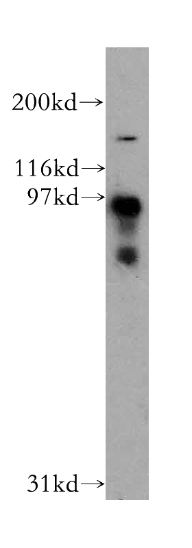 human liver tissue were subjected to SDS PAGE followed by western blot with Catalog No:109882(DCBLD2 antibody) at dilution of 1:500