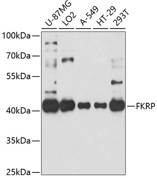Western blot - FKRP Polyclonal Antibody 