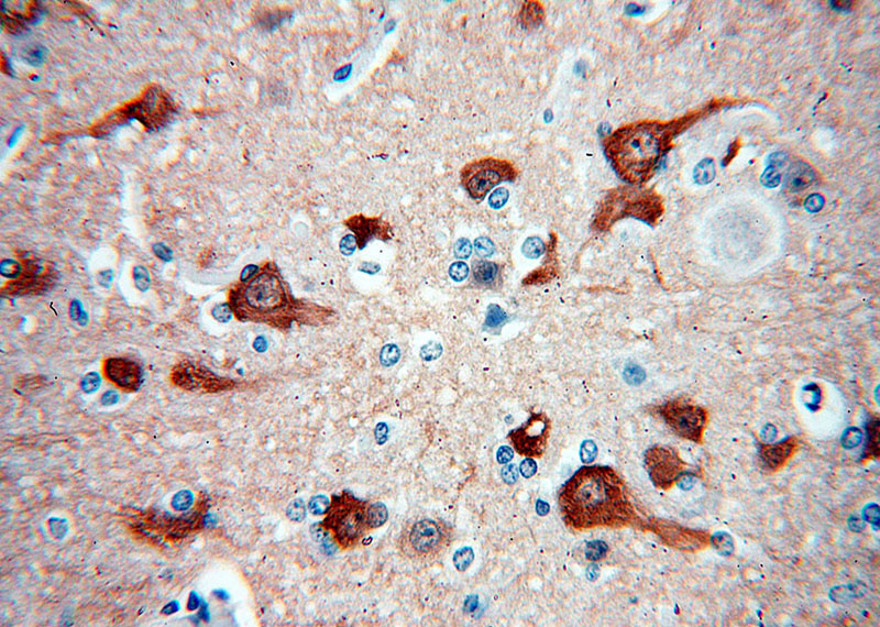 Immunohistochemical of paraffin-embedded human brain using Catalog No:113128(NRGN antibody) at dilution of 1:50 (under 40x lens)