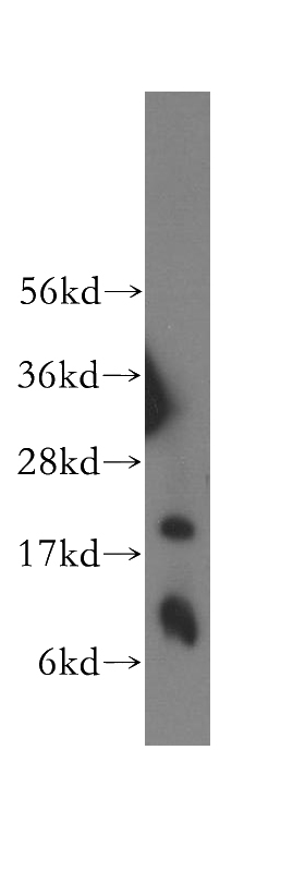 human lung tissue were subjected to SDS PAGE followed by western blot with Catalog No:117095(BCL2A1 antibody) at dilution of 1:500