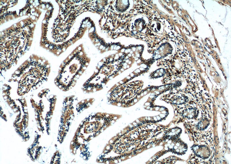 Immunohistochemistry of paraffin-embedded human small intestine tissue slide using Catalog No:111497(HNF4G Antibody) at dilution of 1:50 (under 10x lens)
