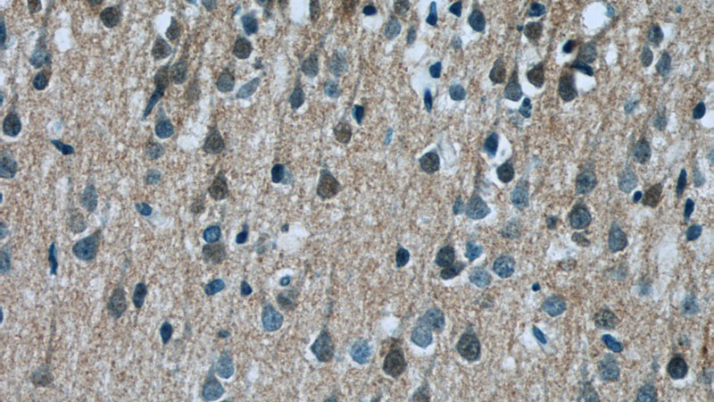 Immunohistochemistry of paraffin-embedded human brain tissue slide using Catalog No:112315(LRCH2 Antibody) at dilution of 1:50 (under 40x lens)