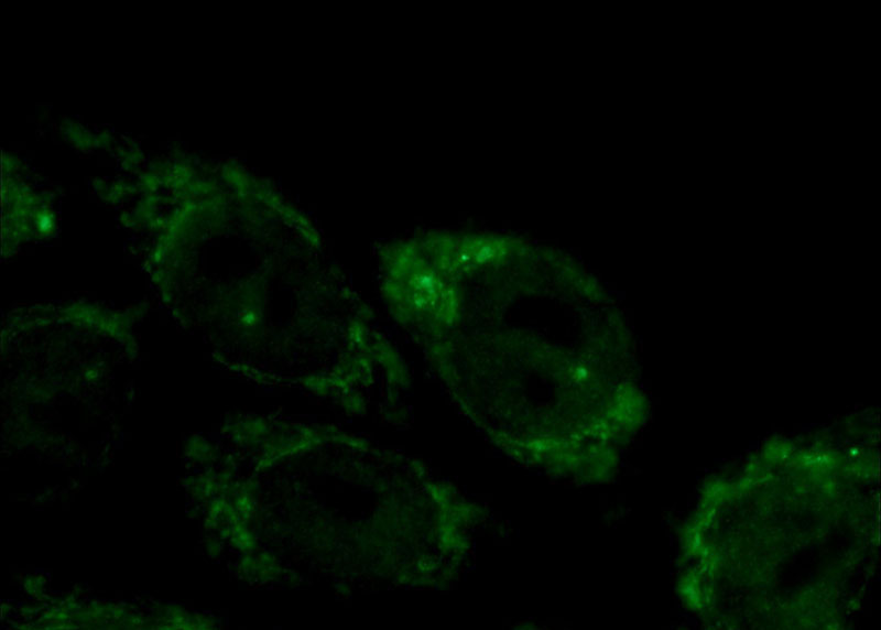 Immunofluorescent analysis of HepG2 cells using Catalog No:109525(CPSF2 Antibody) at dilution of 1:50 and Alexa Fluor 488-congugated AffiniPure Goat Anti-Rabbit IgG(H+L)