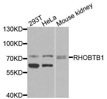 Western blot - RHOBTB1 Polyclonal Antibody 