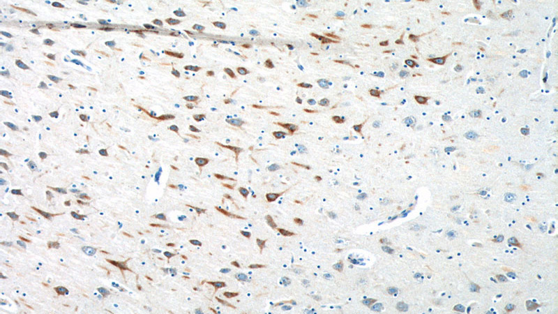 Immunohistochemistry of paraffin-embedded human brain tissue slide using Catalog No:114267(PTGER3 Antibody) at dilution of 1:200 (under 10x lens).