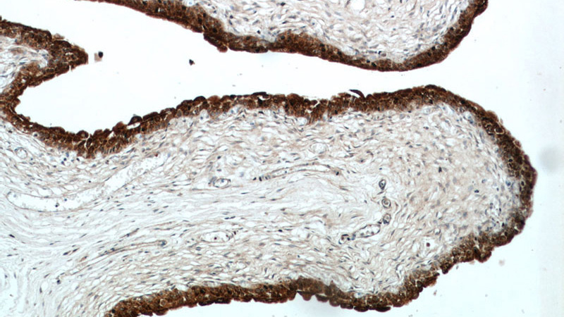 Immunohistochemical of paraffin-embedded human bladder using Catalog No:116629(UPK2 antibody) at dilution of 1:50 (under 10x lens)