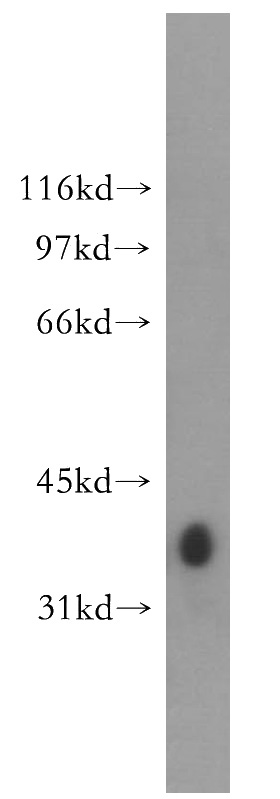human brain tissue were subjected to SDS PAGE followed by western blot with Catalog No:111318(GYG1 antibody) at dilution of 1:300