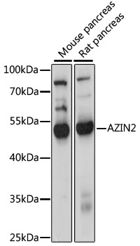 Western blot - AZIN2 Polyclonal Antibody 