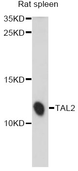 Western blot - TAL2 Polyclonal Antibody 