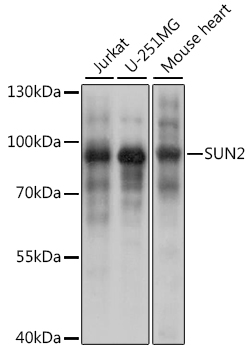 Western blot - SUN2 Polyclonal Antibody 