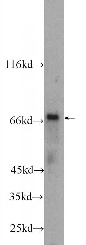 rat liver tissue were subjected to SDS PAGE followed by western blot with Catalog No:111495(HNF1A antibody) at dilution of 1:1000