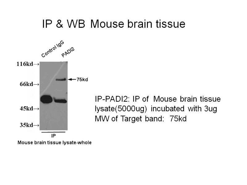 IP result of anti-PADI2 (Catalog No:113482 for IP and Detection) with mouse brain tissue lysate.