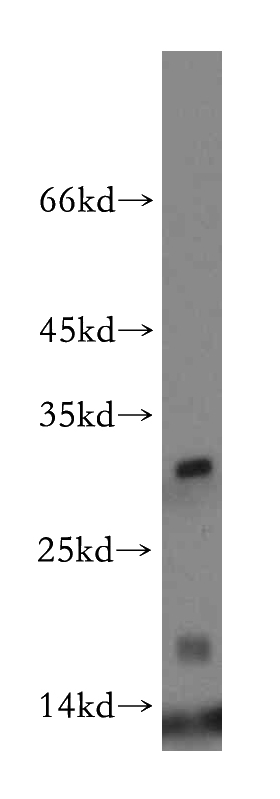 human heart tissue were subjected to SDS PAGE followed by western blot with Catalog No:111270(HBM-Specific antibody) at dilution of 1:300