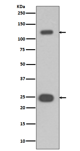 Western blot analysis of PARP expression in Jurkat cell lysate.